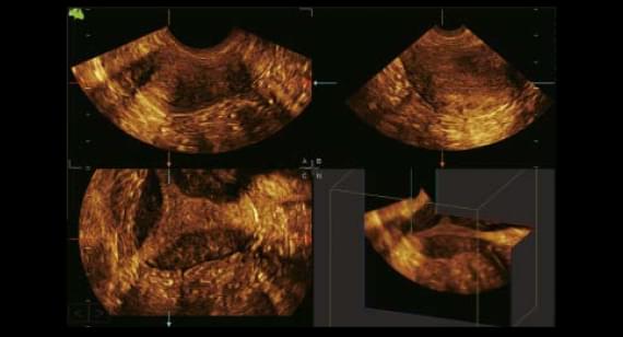 gynecologist-2.jpg gynecologist-2.jpg