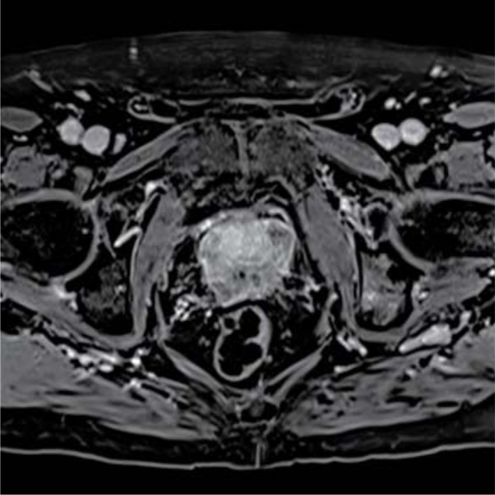 Клинические возможности МРТ Siemens Magnetom Avanto 1,5Т Tim+Dot