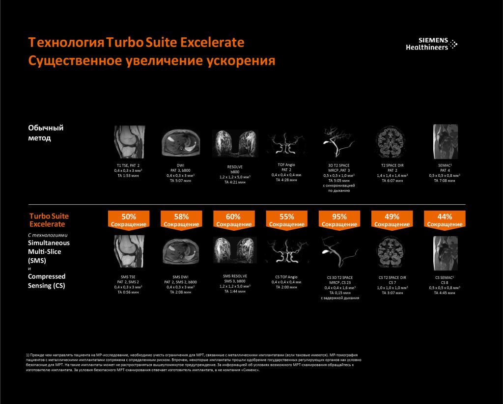 С помощью технологии Turbo Suite вы можете ускорить весь процесс МРТ-исследования до 50 % для всех контрастов, ориентаций и участков тела. С помощью технологии Turbo Suite вы можете ускорить весь процесс МРТ-исследования до 50 % для всех контрастов, ориентаций и участков тела.